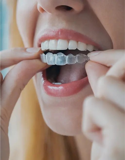 Invisalign in Pleasantville