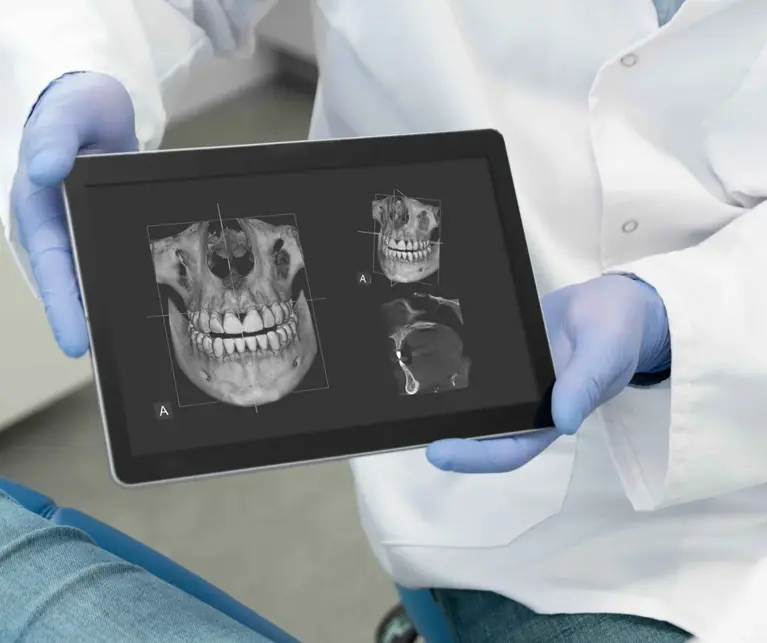 Dental X-ray showing on a tablet