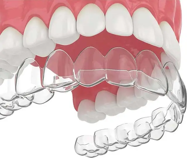 Invisalign Pleasantville